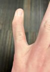 my-pinky-fingers-are-naturally-crooked-v0-z7octp9g4yjc1.jpg
