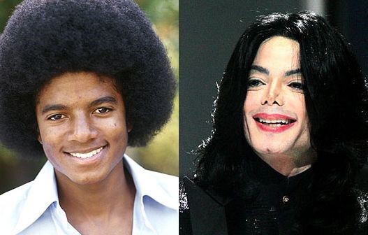 Michael-Jackson-before-and-after-plastic-surgery.jpg